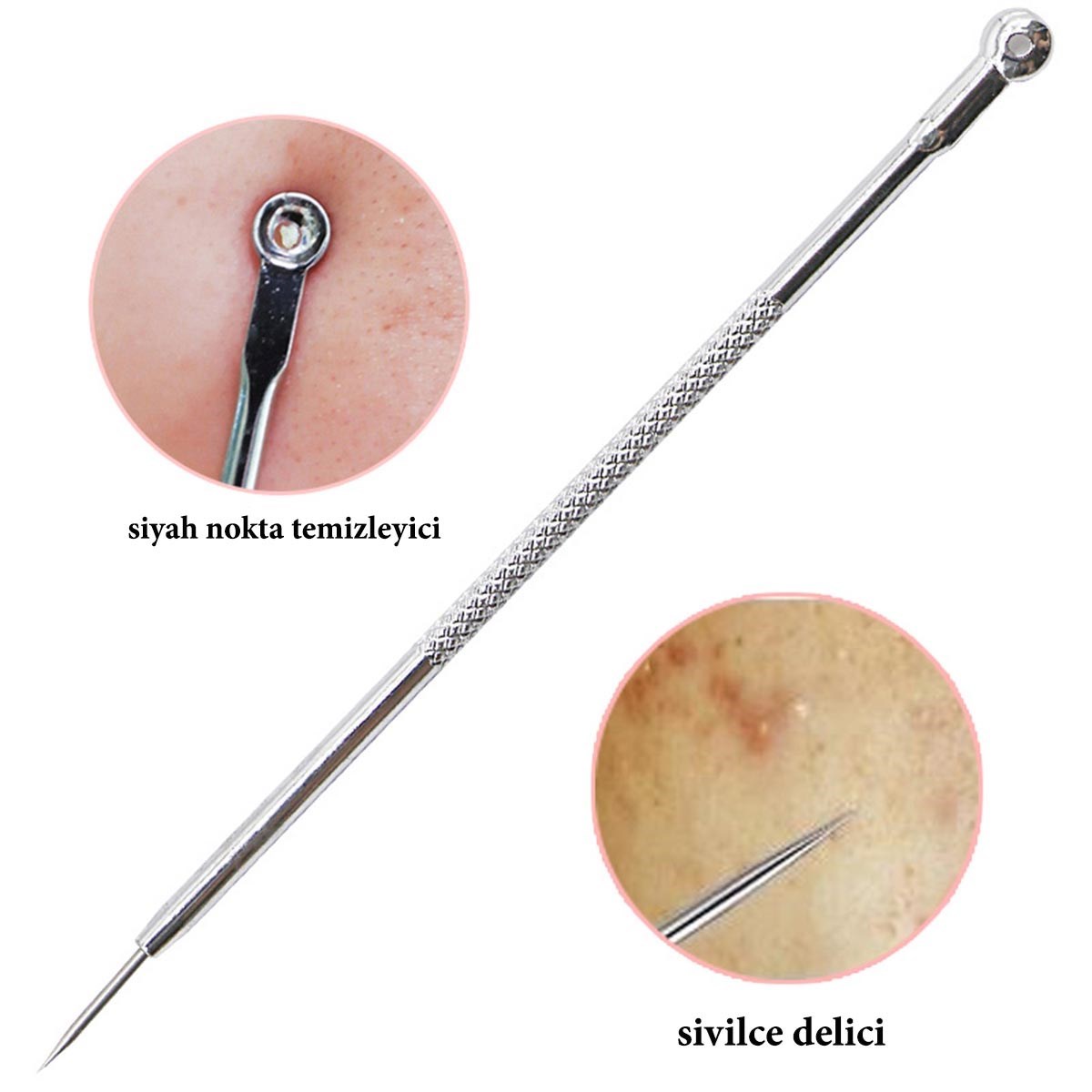 BUFFER® Paslanmaz Çelik Siyah Nokta Sivilce ve Akne Temizleyici Set 3lü Kit